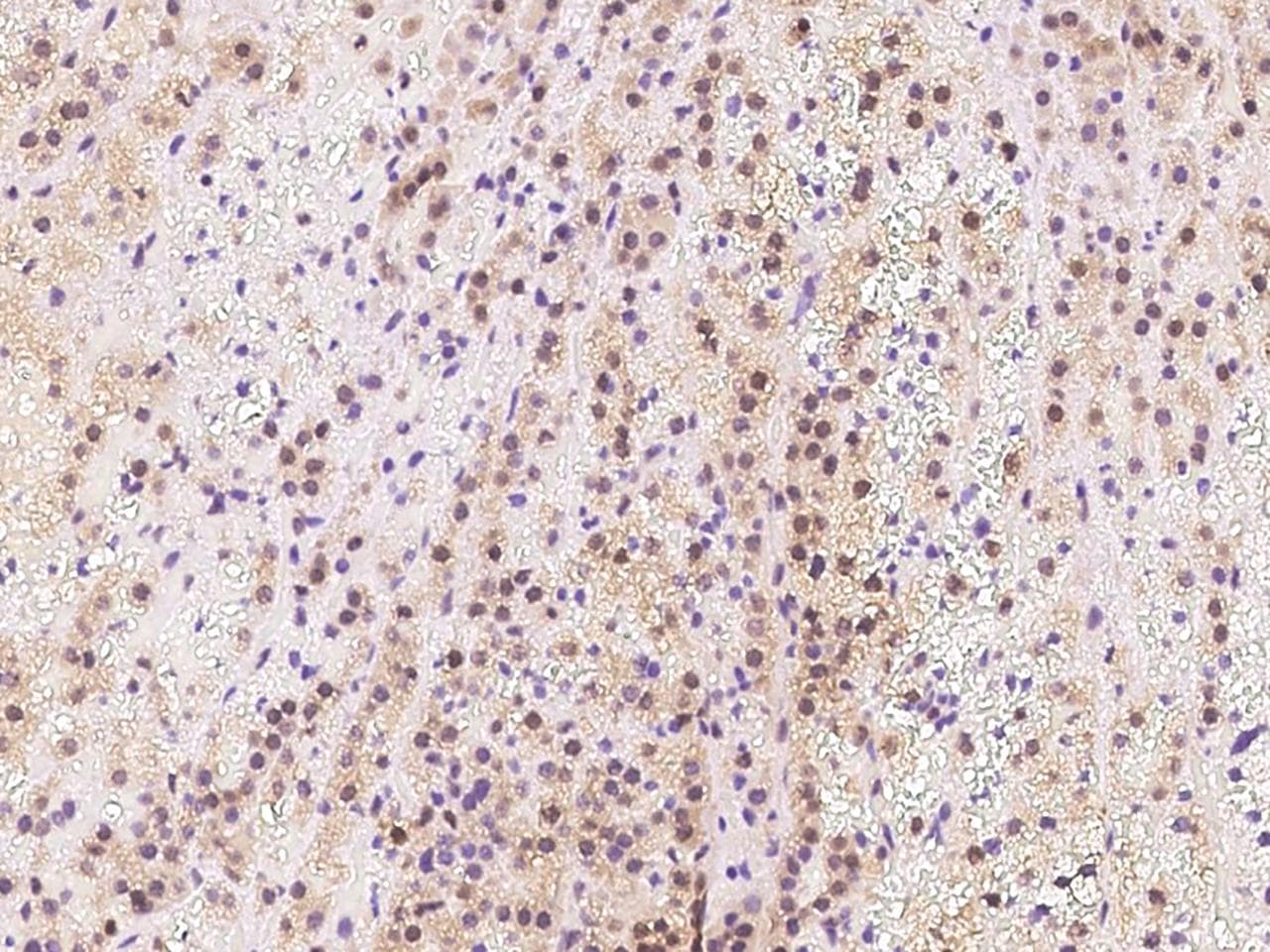 TIPRL / TIP Antibody