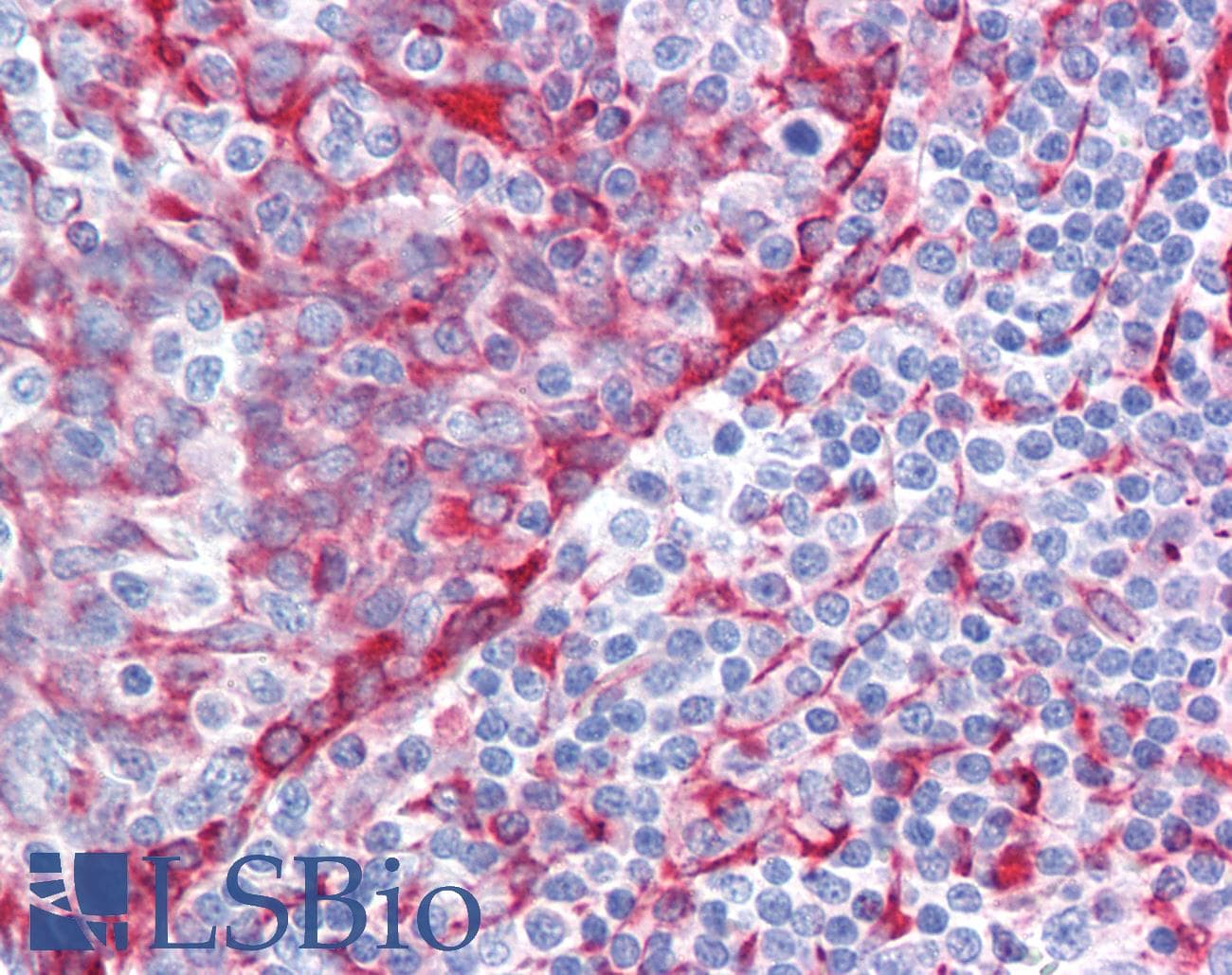 IHC-plus™ Polyclonal Rabbit anti-Human TMEM173 / STING Antibody (aa311-340, IHC, WB)