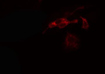 ADPGK Antibody