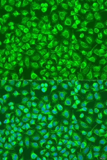 ENTPD5 / CD39L4 Antibody