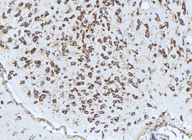 Polyclonal Rabbit anti-Human PSAT1 Antibody (IHC, IF, WB)