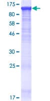 Human PALD1 / Paladin 1 Protein (Recombinant GST)