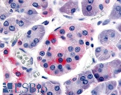IHC-plus™ SSTR5 Antibody (C-Terminus)