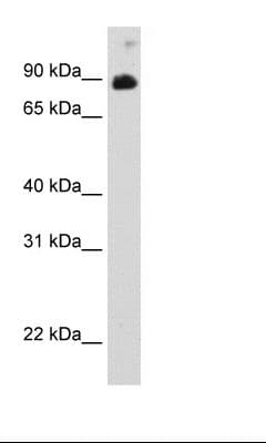 STAT6 Antibody (C-Terminus)