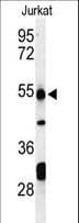 IHC-plus™ PRUNE Antibody (aa360-389)