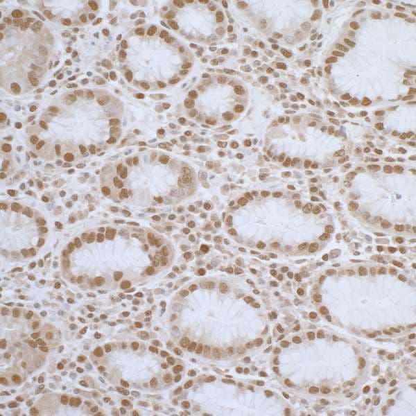 Polyclonal Rabbit anti-Human ELAC2 Antibody (aa776-826, IHC, WB)