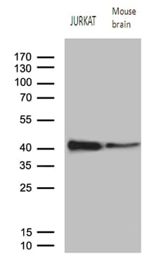 RCAN1 / DSCR1 Antibody (clone OTI10C6, Carrier-free)