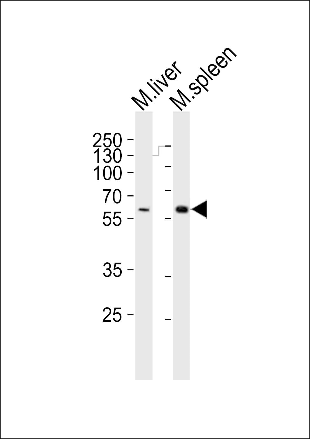 SRMS Antibody (aa113-147)