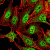 PRMT4 / CARM1 Antibody (clone 3H2)