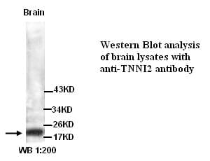 IHC-plus™ TNNI2 Antibody