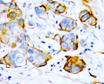 Polyclonal Rabbit anti-Human PTPN11 / SHP-2 / NS1 Antibody (aa578-592, IHC, WB)