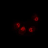 DTNBP1 / Dysbindin Antibody