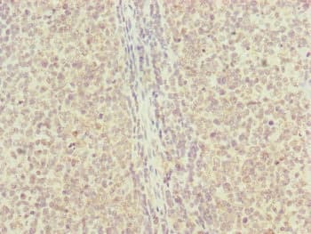 Polyclonal Rabbit anti-Human RNF13 Antibody (IHC, WB)