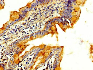 Polyclonal Rabbit anti-Human RAB3GAP2 / p150 Antibody (IHC, WB)