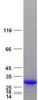 Human C1QTNF5 / CTRP5 Protein (Recombinant Myc-DDK (Flag))