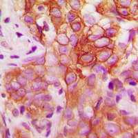 SYN / FYN Antibody (phospho-Tyr530)