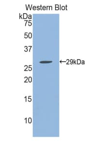 IFNAR1 / IFNAR Antibody (aa104-341)
