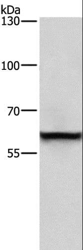 TRIP4 / ASC-1 Antibody