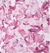 COL5A1 / Collagen V Alpha 1 Antibody (clone 6A7)
