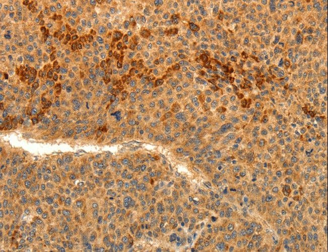 TRPM7 Antibody