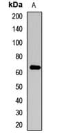 COL10A1 / Collagen X Antibody