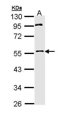 MPP1 Antibody (aa1-304)