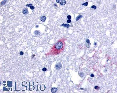 IHC-plus™ Polyclonal Rabbit anti-Human GPR48 / LGR4 Antibody (Cytoplasmic Domain, IHC)