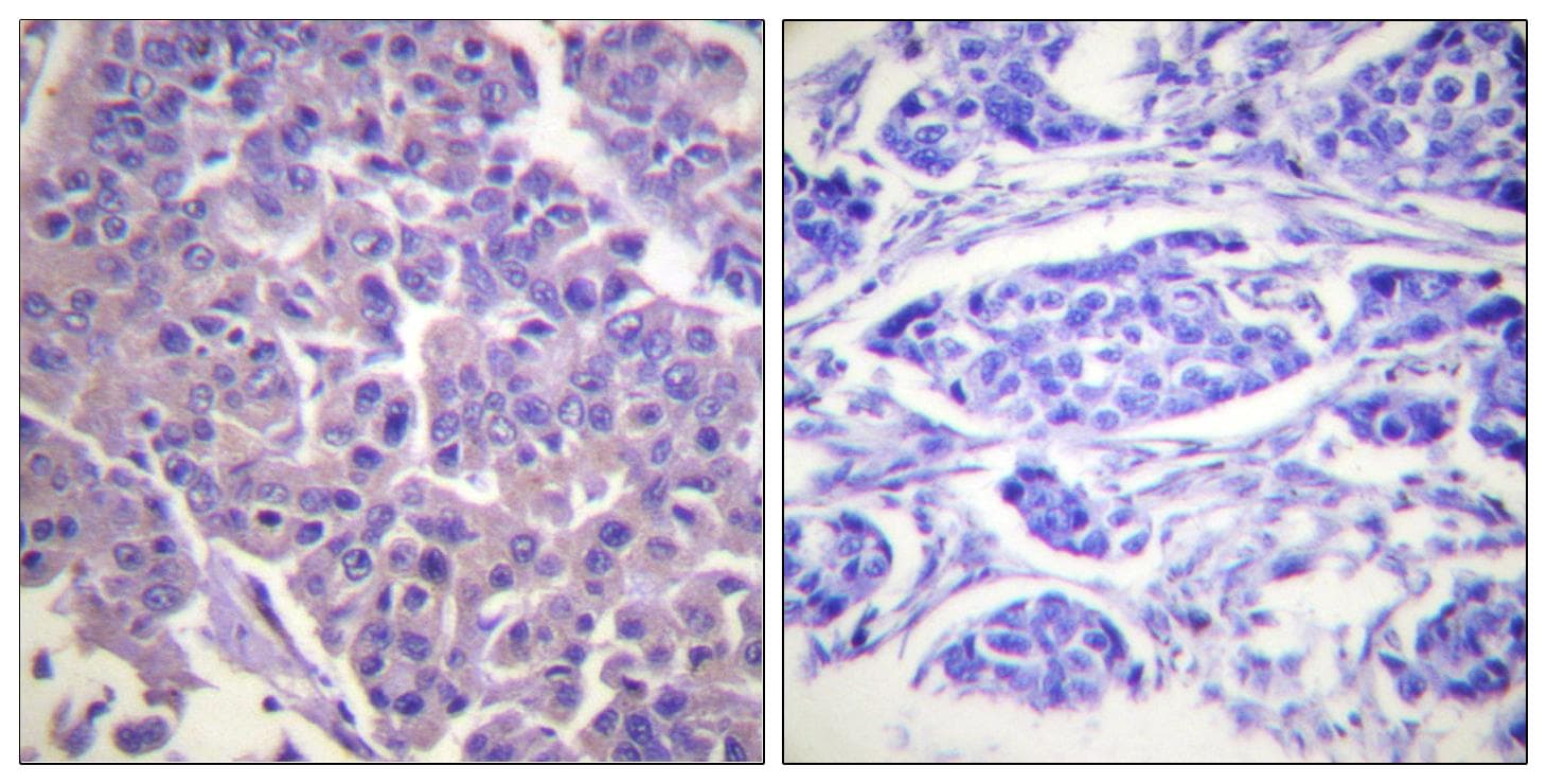 Polyclonal Rabbit anti-Human CALD1 / Caldesmon Antibody (aa744-793, IHC, IF, WB)