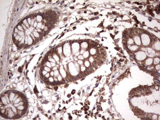 Monoclonal Mouse anti-Human BFSP2 Antibody (clone OTI4E7, aa184-415, IHC, WB)
