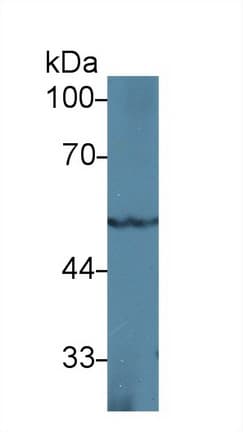 PPARG / PPAR Gamma Antibody (aa149-273, APC)