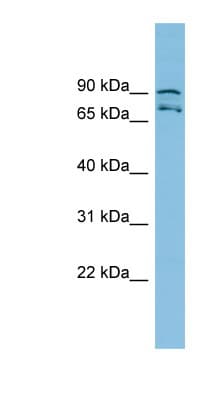 MTRR Antibody (aa71-120)