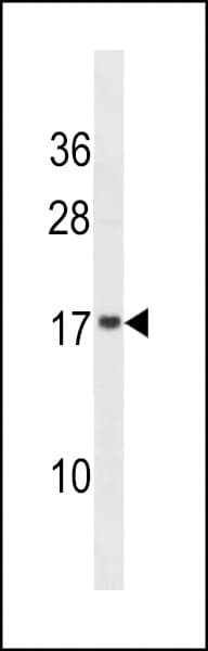 VAMP4 / VAMP-4 Antibody (aa61-90)
