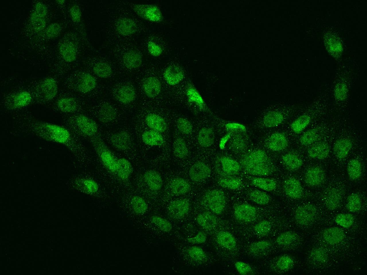 Polyclonal Rabbit anti-Human MBTD1 Antibody (IF)