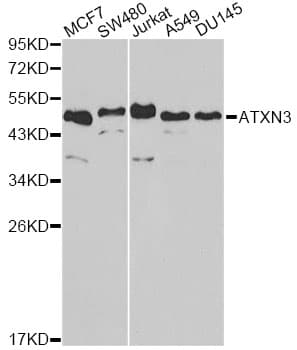 Polyclonal Rabbit anti-Human ATXN3 / JOS Antibody (IHC, IF, WB)
