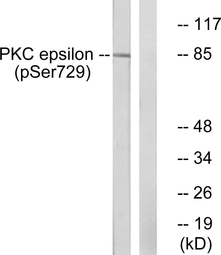 PRKCE / PKC-Epsilon Antibody (phospho-Ser729)