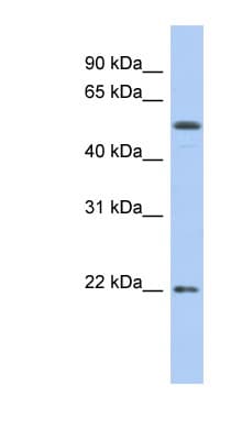 PathPlus™ Polyclonal Rabbit anti-Human OCLN / Occludin Antibody (aa35-84, IHC, WB)