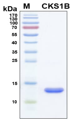 Human CKS1B / CKS1 Protein (Recombinant 6His, N-terminus)