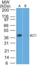 IHC-plus™ Leukotriene B4 Receptor / BLT1 Antibody