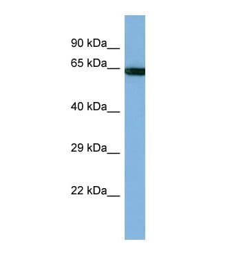 PCDHB14 Antibody (aa121-170)