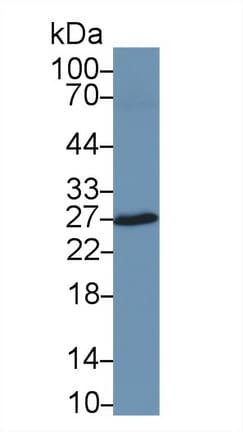 CA2 / Carbonic Anhydrase II Antibody (APC)