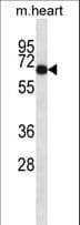 ADCK1 Antibody (aa448-475)