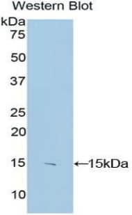 S100B / S100 Beta Antibody (aa1-92)