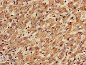 Polyclonal Rabbit anti-Human TGDS Antibody (IHC)