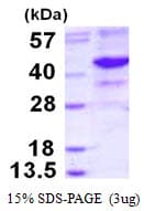 Human NEIL2 Protein (Recombinant His)