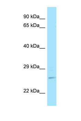 RAB11A Antibody (C-Terminus)