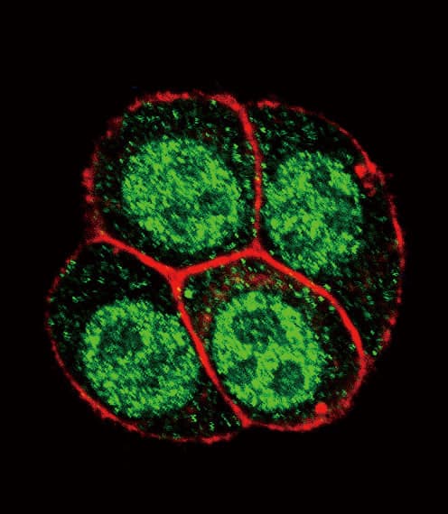 SMAD2 Antibody (phospho-Ser118)