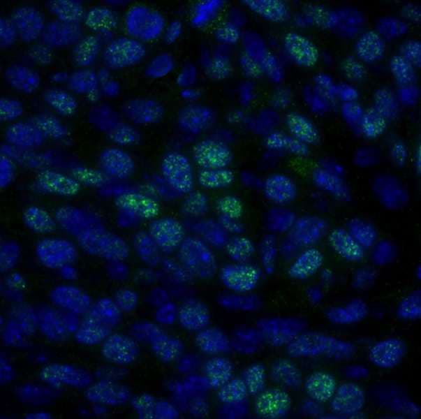Polyclonal Rabbit anti-Human HDAC1 Antibody (aa425-C-term, IHC, IF)