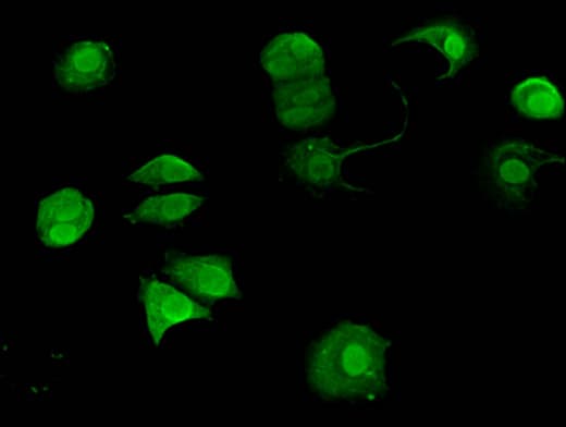 SLC4A9 / AE4 Antibody