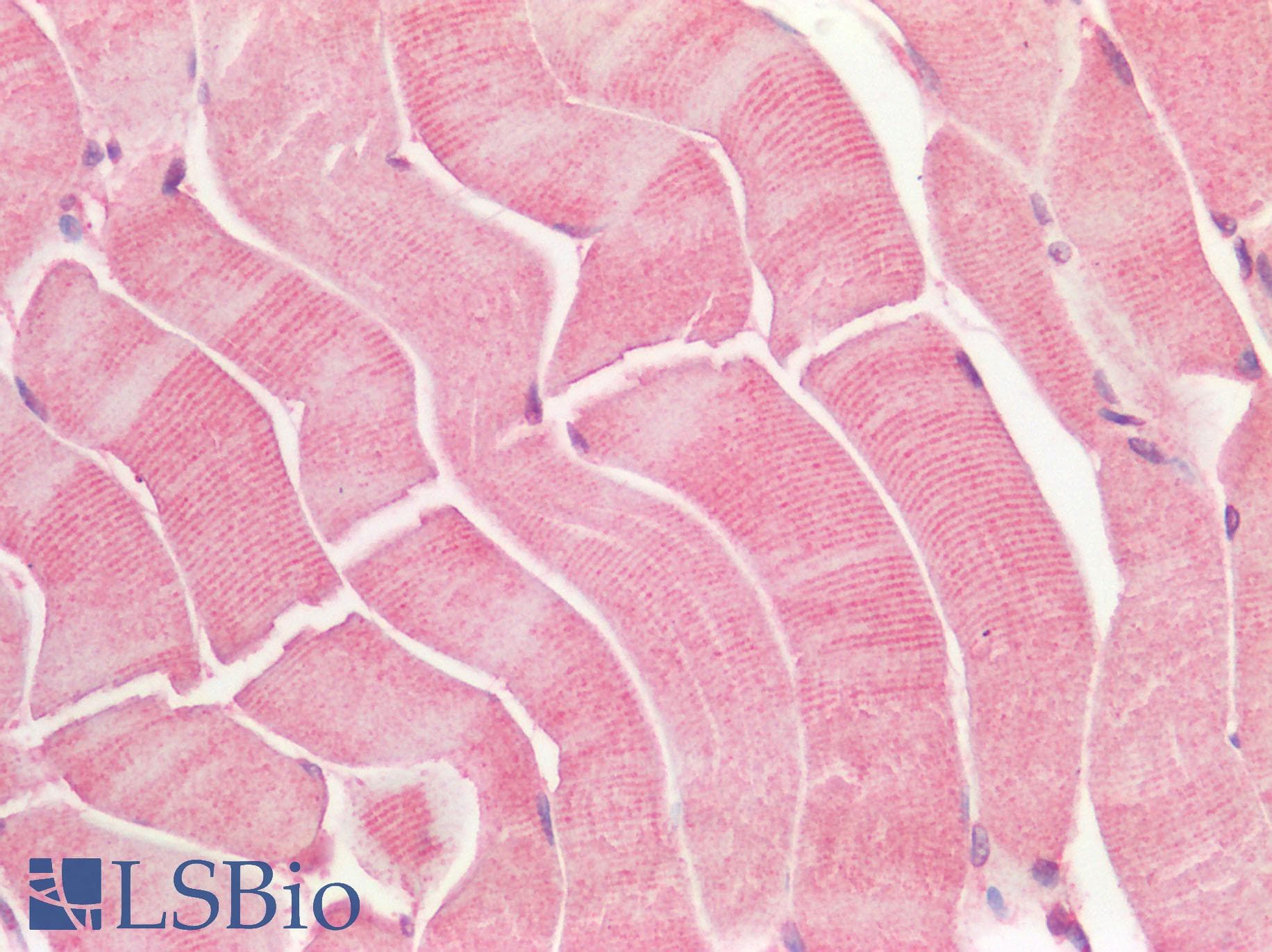 GPR49 / LGR5 Antibody (N-Terminus)