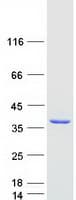 Human HAAO Protein (Recombinant Myc-DDK (Flag))